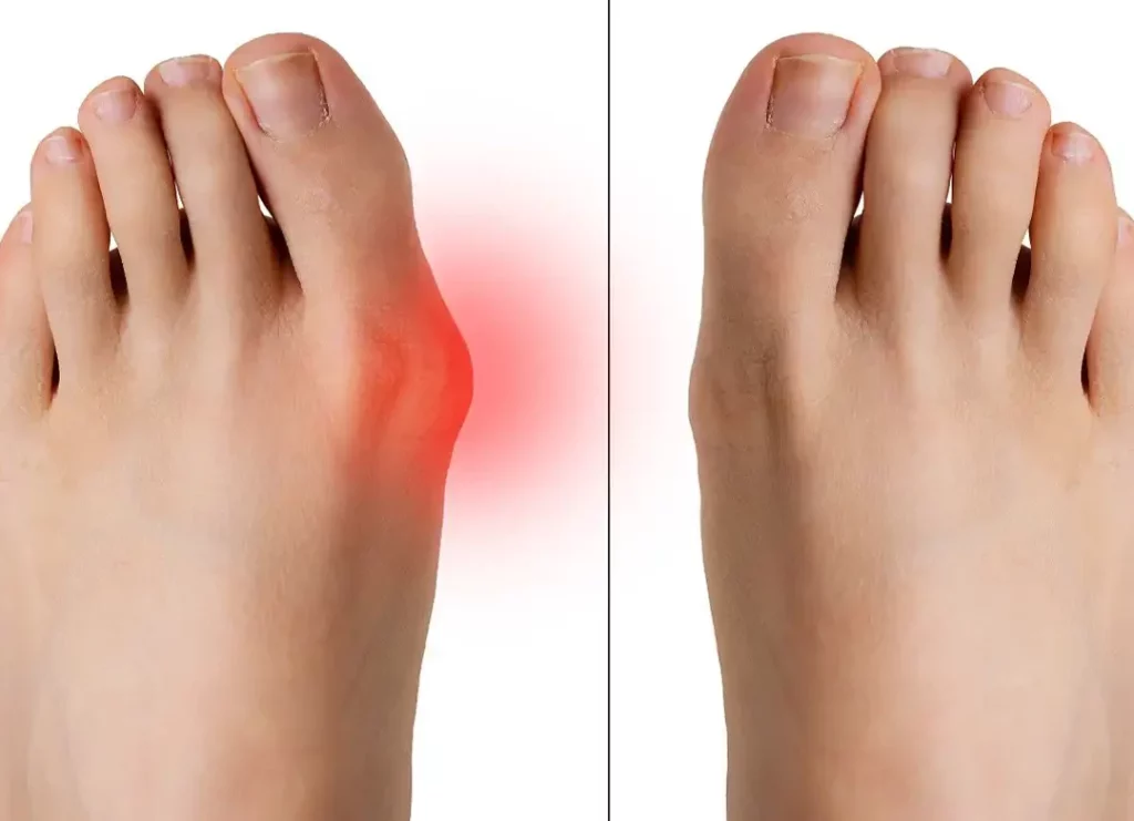 Comment soulager la douleur derrière la cuisse : conseils pratiques et exercices efficaces