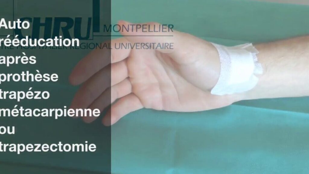 Rééducation après fracture de l’humérus : conseils et exercices pour une récupération optimale