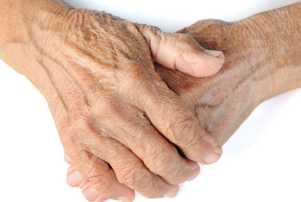 Les causes et traitements de l’épicondylite latérale : tout savoir sur le golf elbow