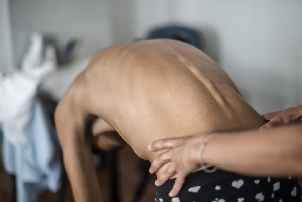 Les pathologies du dos : comprendre et prévenir les maux lombaires