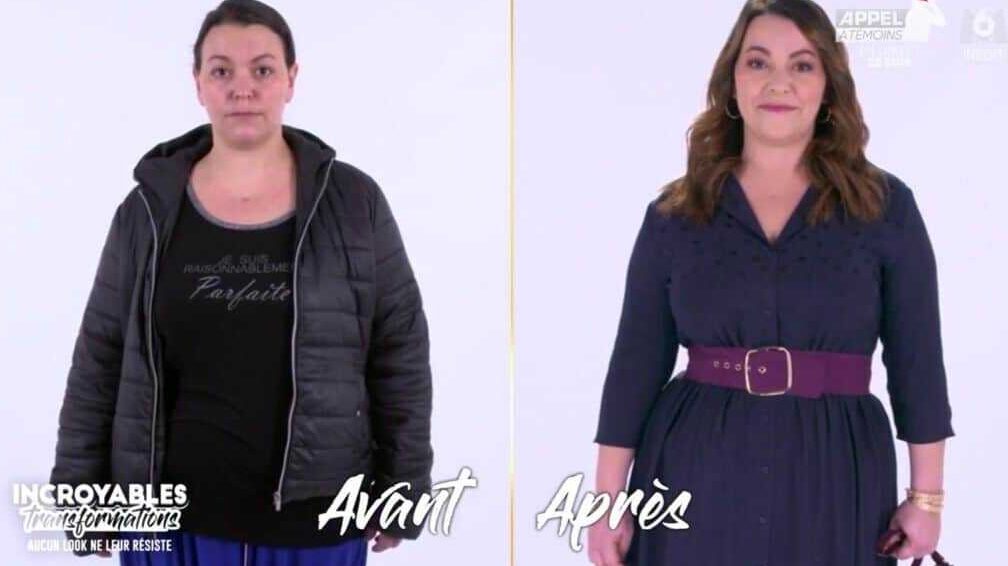 Transformation avant-après de la pressothérapie : découvrez les incroyables résultats
