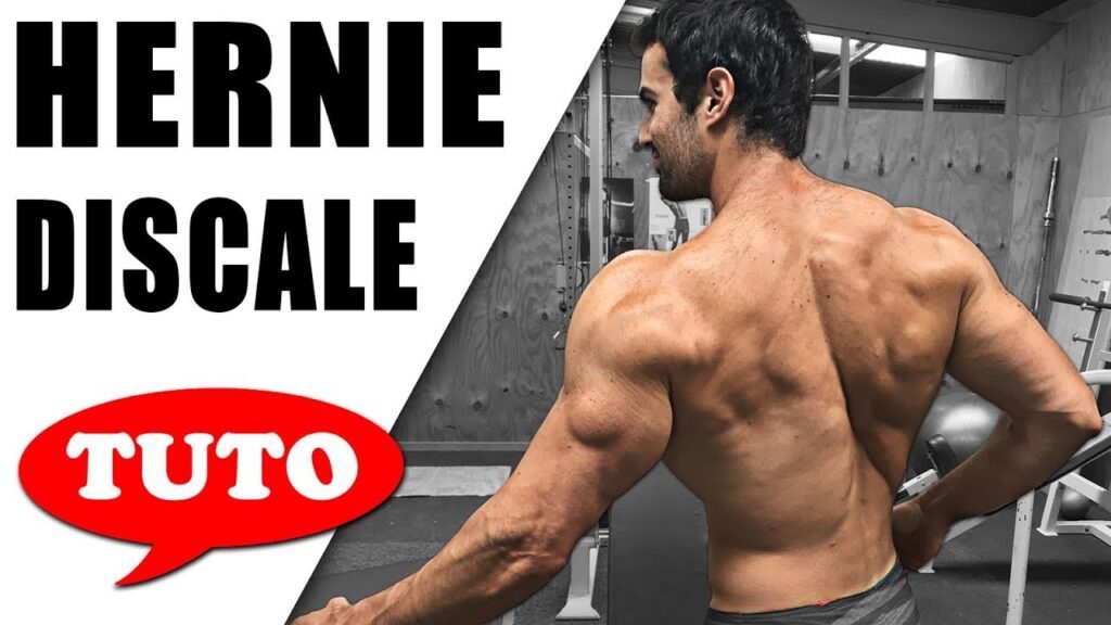 Programme de musculation adapté pour les personnes atteintes d’une hernie discale