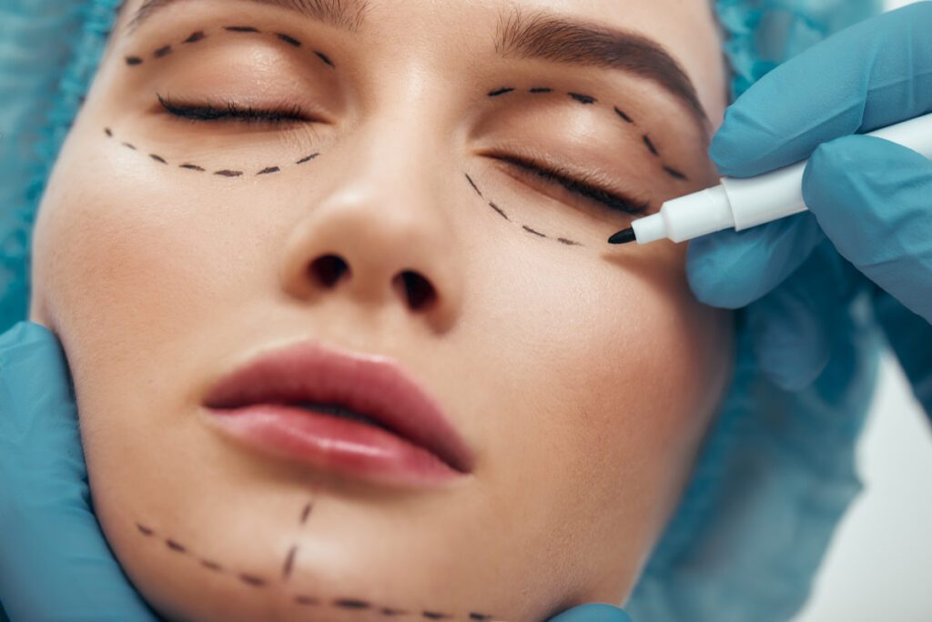 femme chirurgie des paupieres