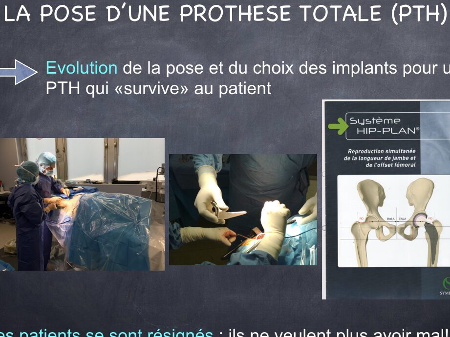 5 exercices essentiels pour se préparer à une prothèse de hanche