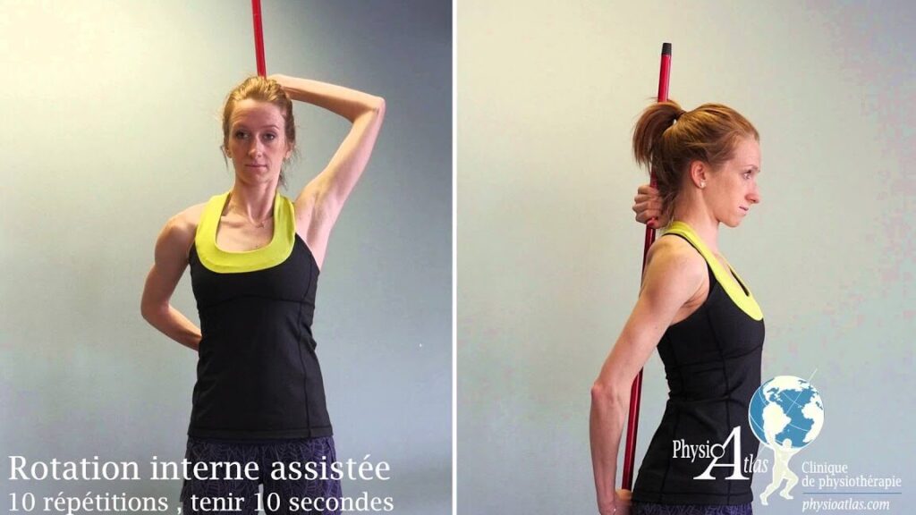 Comment soulager la capsulite rétractile par des exercices de rééducation ?