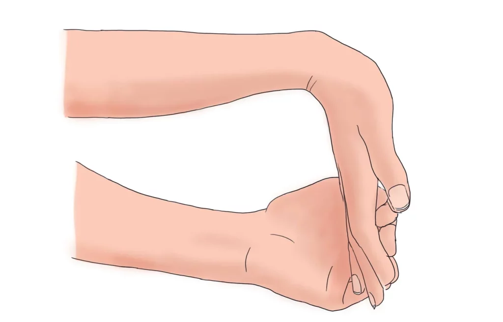Comprendre et Contrer les Déformations des Doigts : Guide Pratique pour une Santé Manuelle Optimale