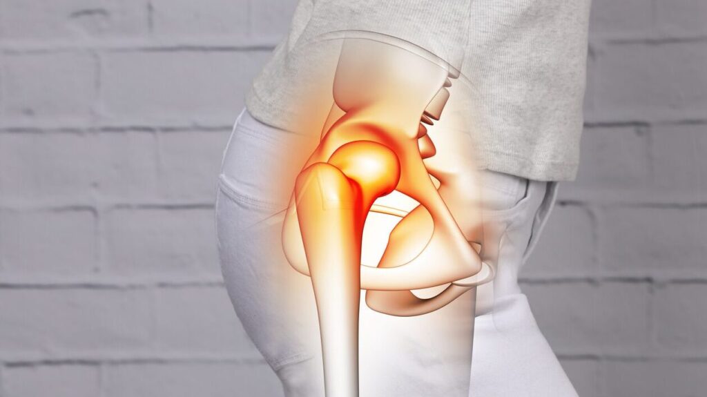 Comprendre et Traiter la Douleur de Hanche Chez l’Adolescent Sportif : Un Guide Complet