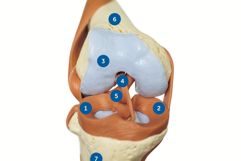 Comprendre et Traiter les Blessures Ligamentaires: Un Guide Complet
