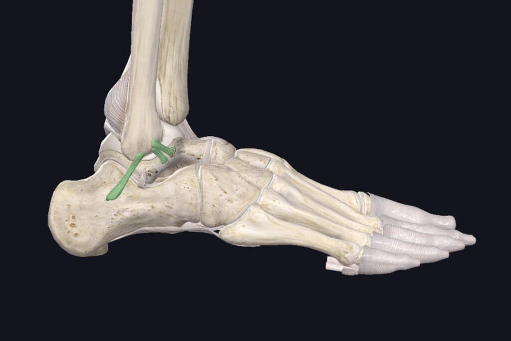 Durée de guérison d’une entorse de Lisfranc : combien de temps faut-il pour se rétablir ?