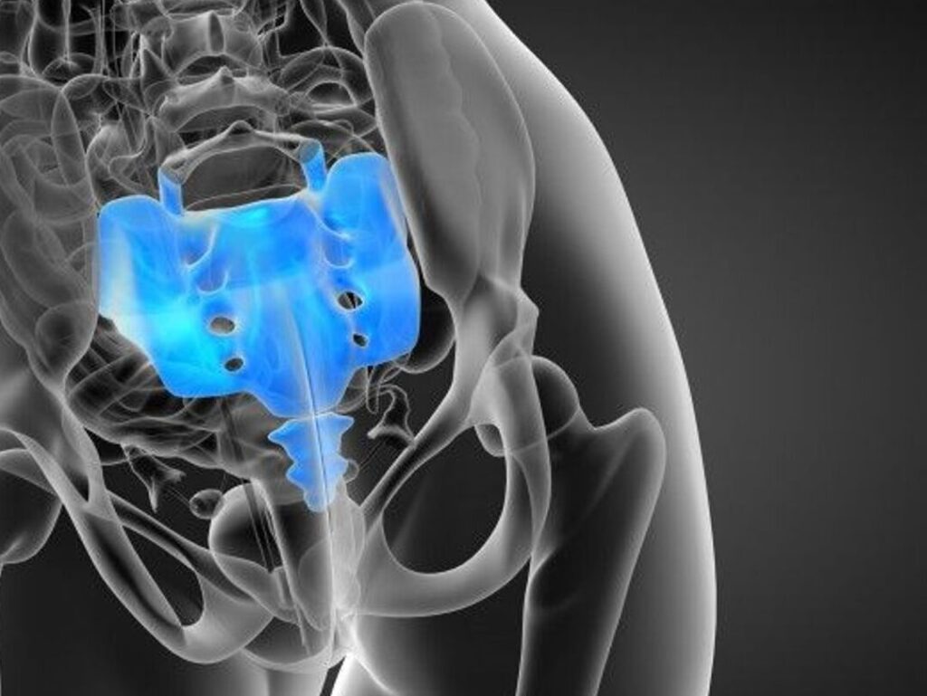 Fracture du Sacrum et Marche : Comprendre, Réagir et Se Rétablir