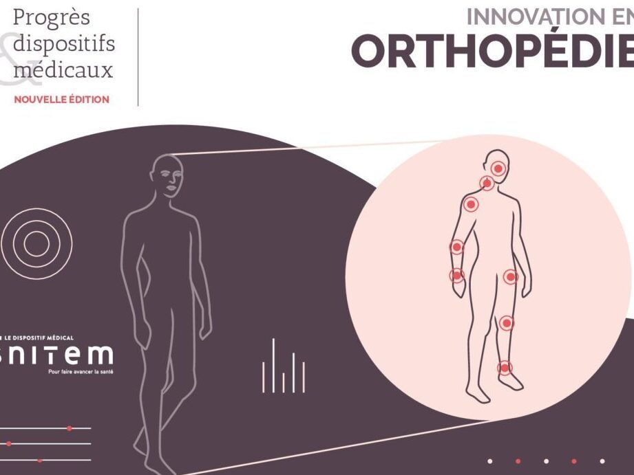 Rééducation par le Vélo: Comment la Kinésithérapie Transforme le Processus de Guérison