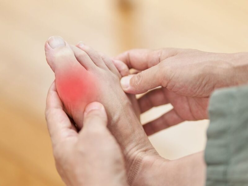 Comment gérer l&rsquo;arthrose déformante du pied au quotidien ?