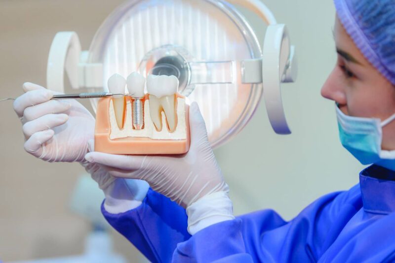 implant dentaire