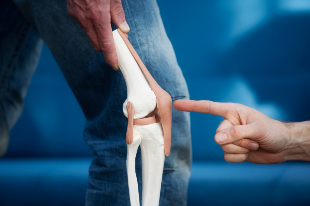 arthrose du genou