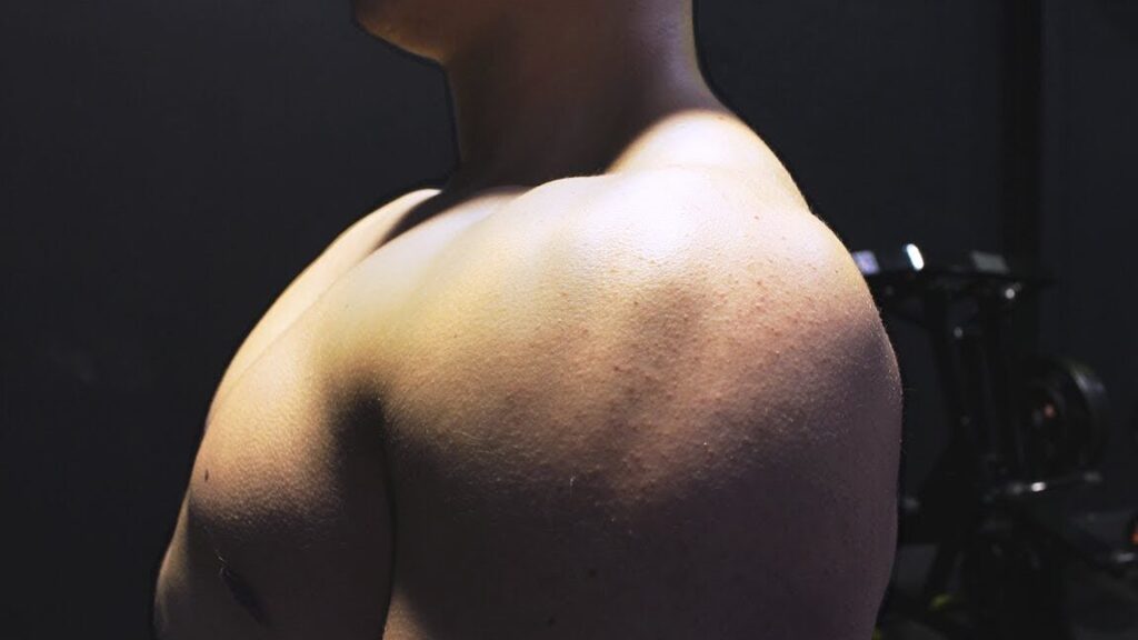 Pourquoi votre épaule craque-t-elle pendant la musculation ?
