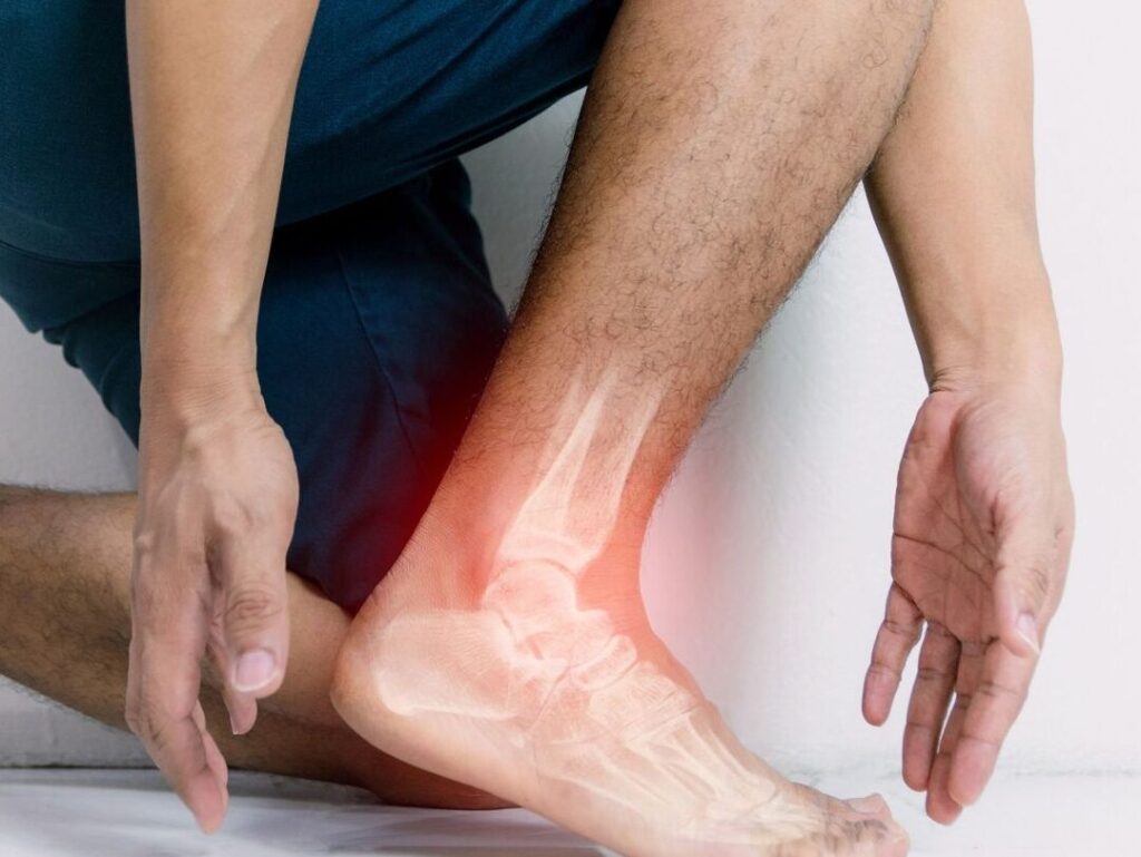 Qu’est-ce que l’enthésopathie du tendon d’Achille et comment la traiter ?