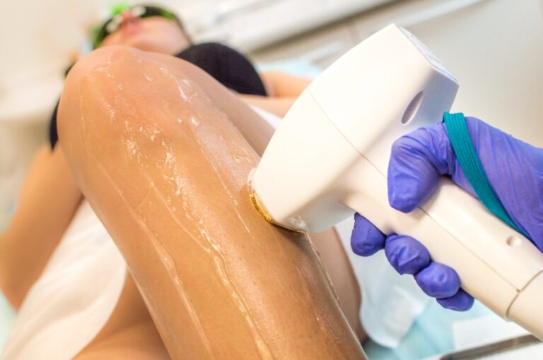 épilation laser jambe