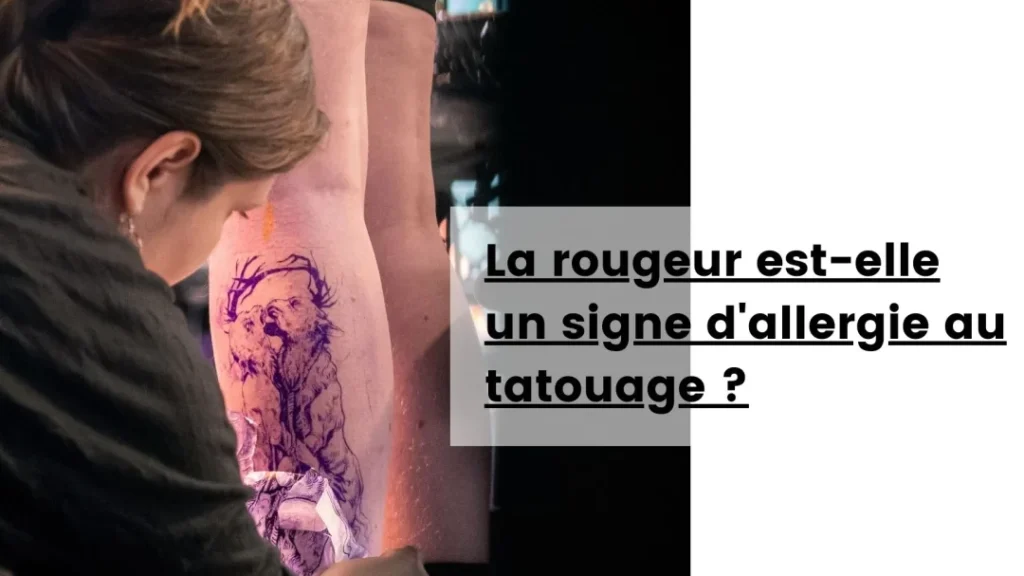 Pourquoi votre tatouage brûle-t-il ? Comprendre les réactions cutanées post-encrage