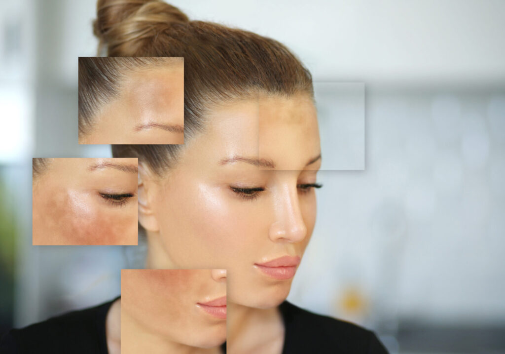 Trouver le meilleur dermatologue à Périgueux : conseils et recommandations