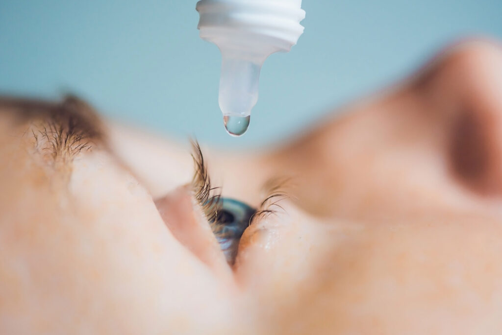 Pourquoi mon œil gratte-t-il sans cesse ? Causes et solutions