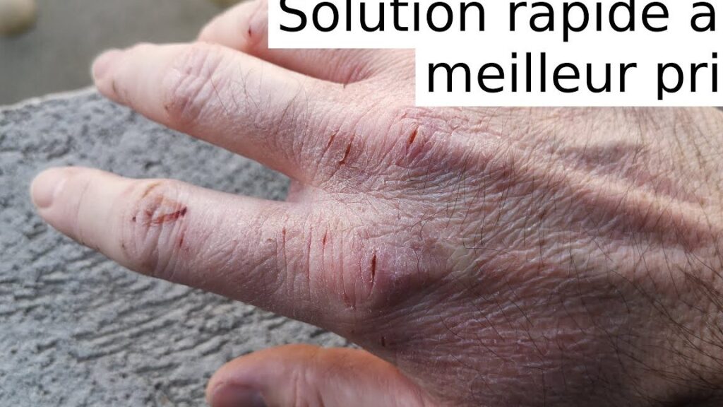Trouver le meilleur dermato à Mâcon : conseils et adresses incontournables