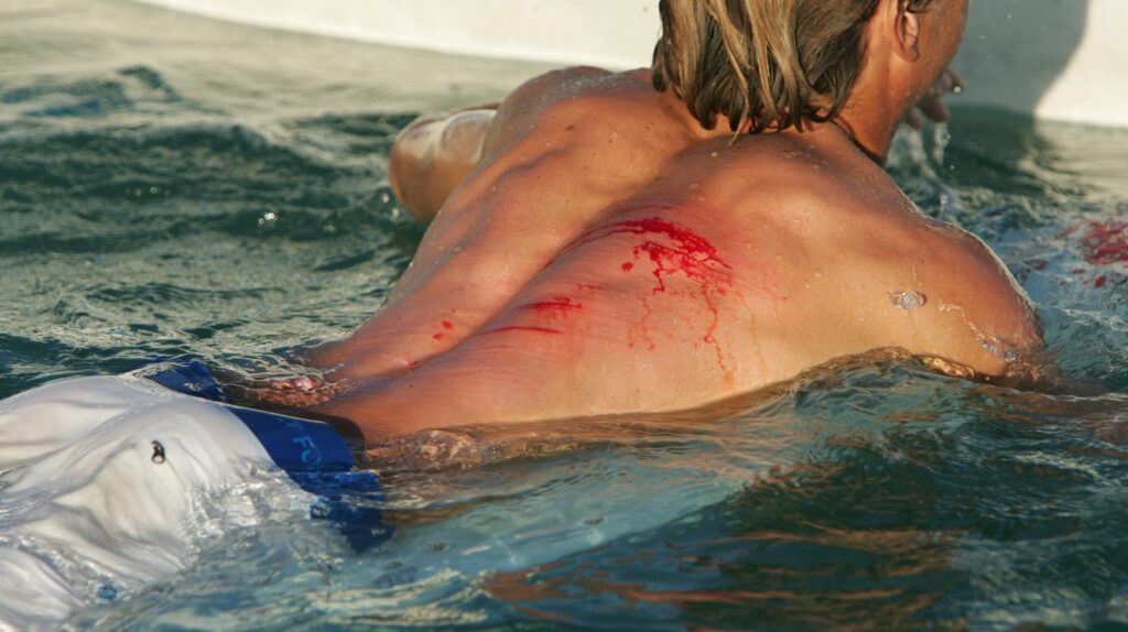 Soins immédiats : comment réagir face à une blessure de corail ?