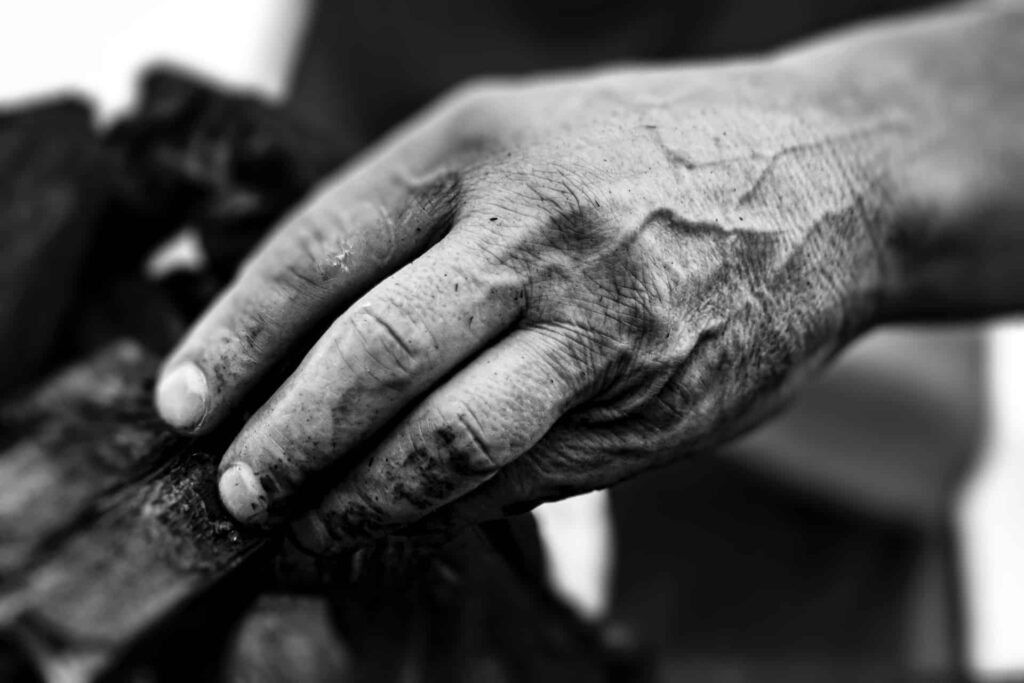 Femme détendue recevant un soin thermal pour soulager la polyarthrite rhumatoïde