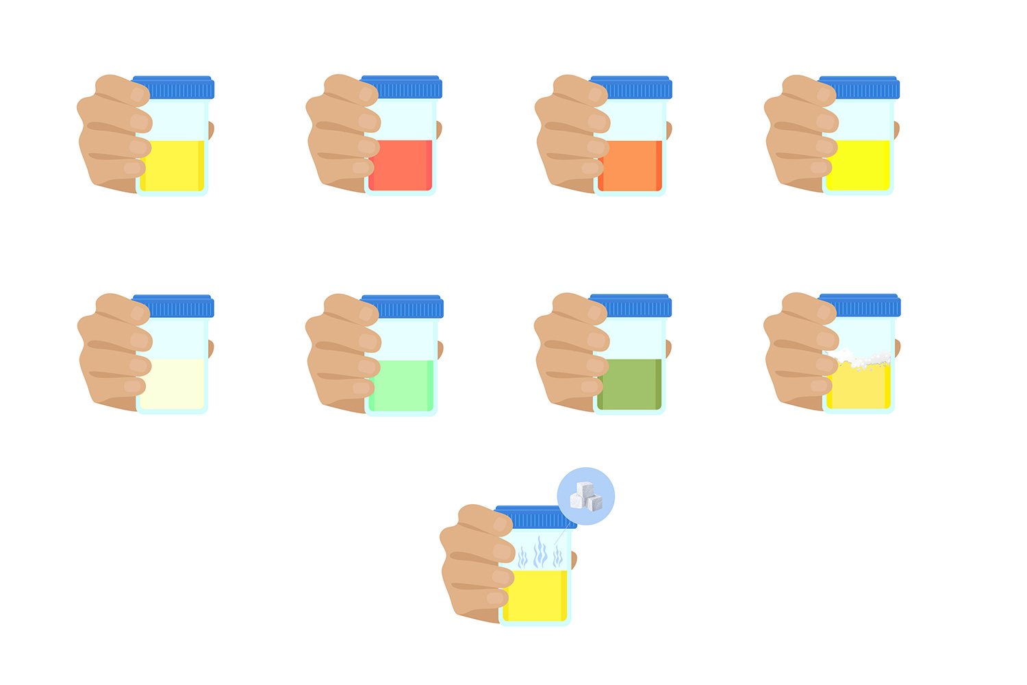 couleurs urine signification