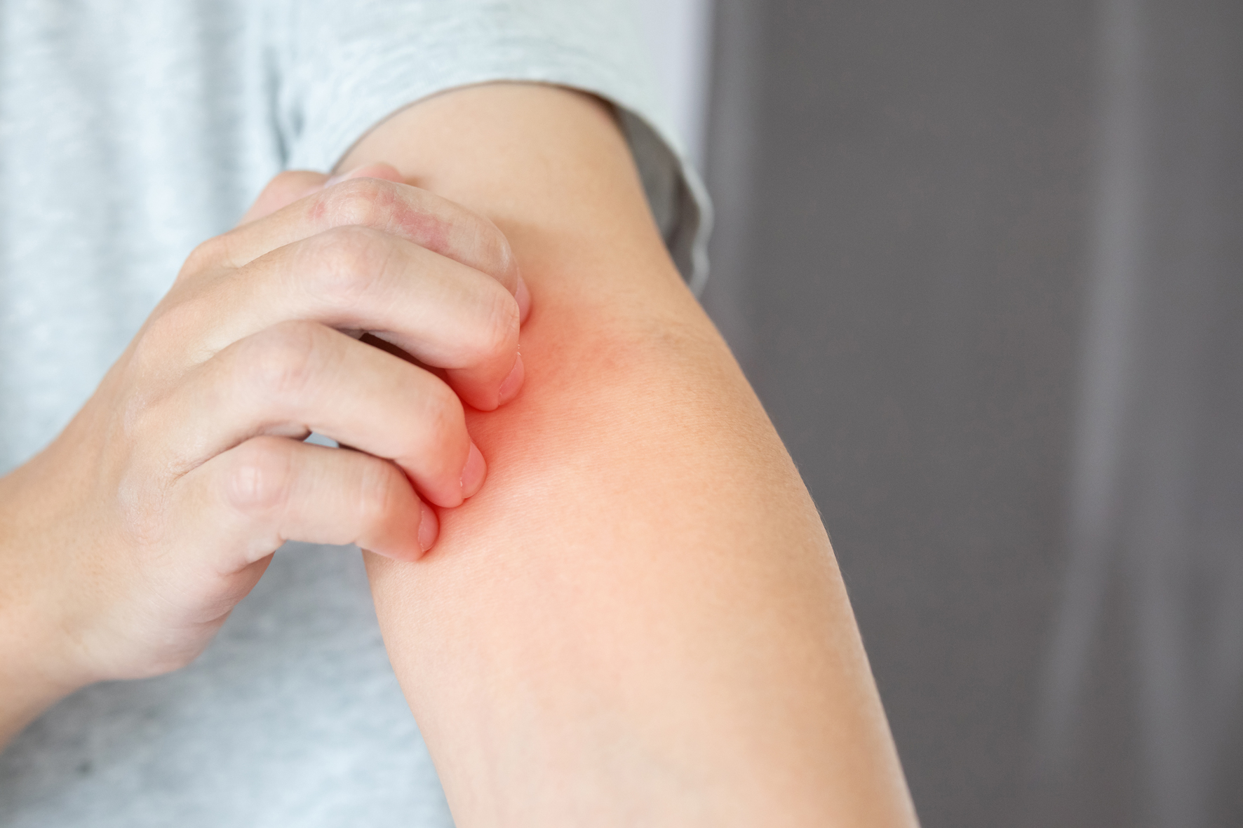 eczéma et signification spirituelle