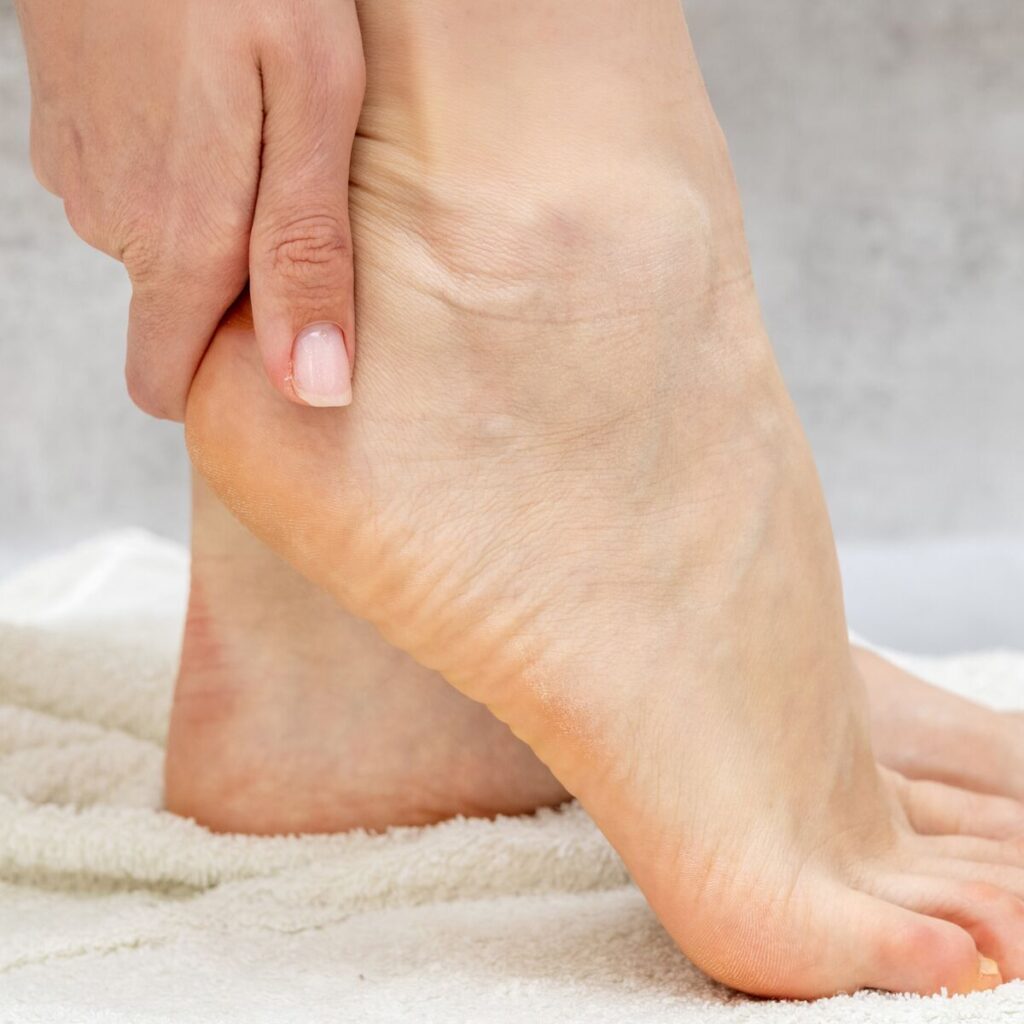 Douleur intense sous le talon gauche, causes et traitements efficaces pour soulager la talalgie plantaire.