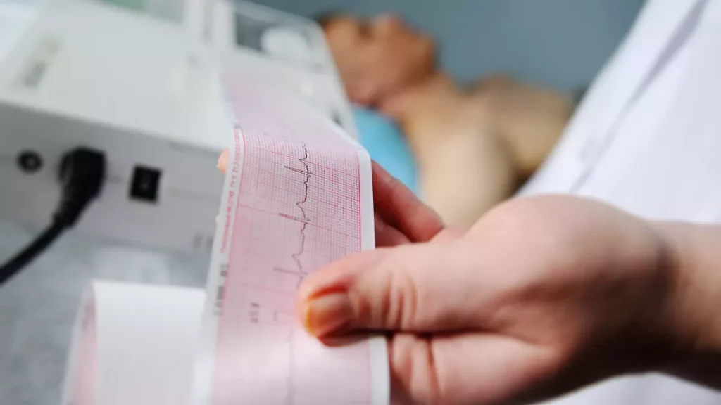 Illustration des causes, symptômes et traitements des extrasystoles