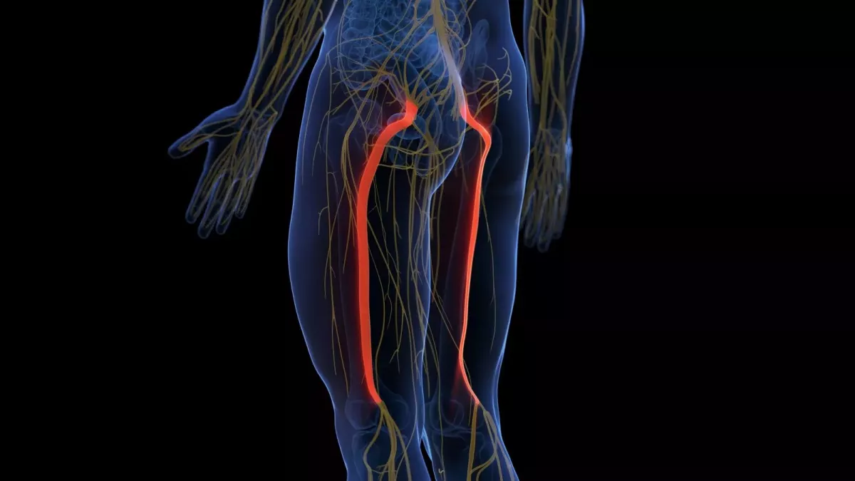 Anatomie du nerf sciatique