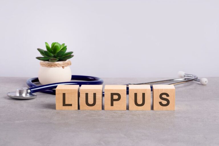 Nouvelle approche prometteuse pour le traitement du lupus