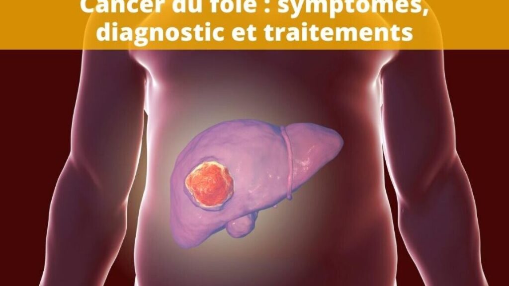 Quelle est l’évolution d’un cancer du foie sans traitement ?