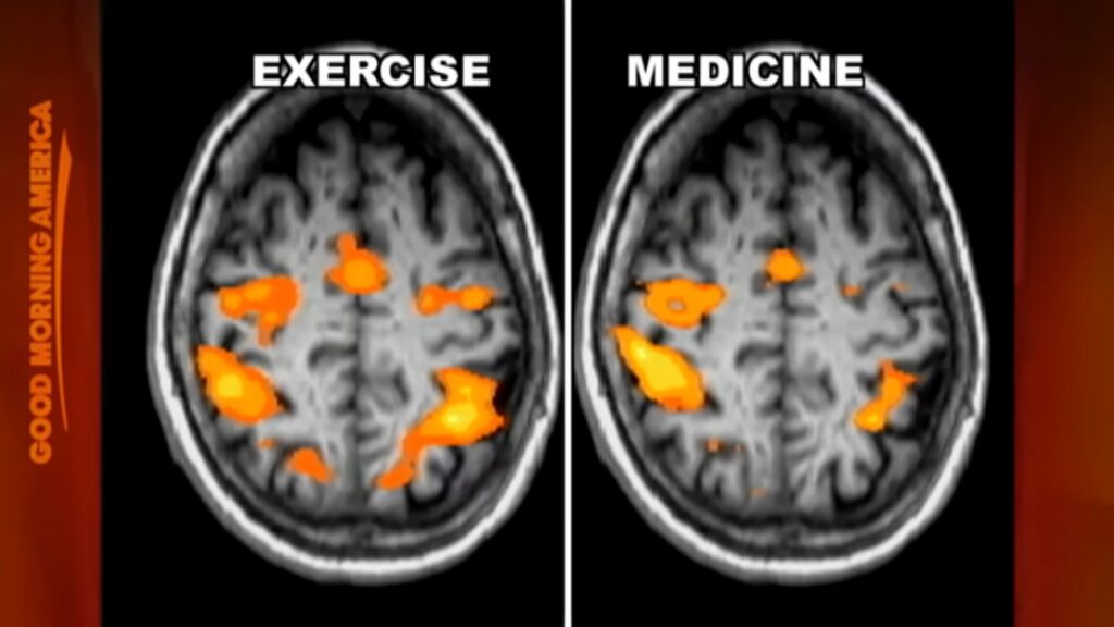 témoignage sur la guérison de Parkinson et méthodes utilisées