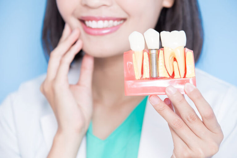 implant dentaire
