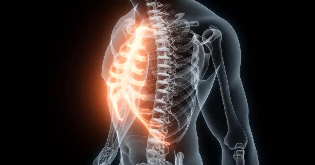 Syndrome de Tietze et stress : quel lien avec la douleur ?