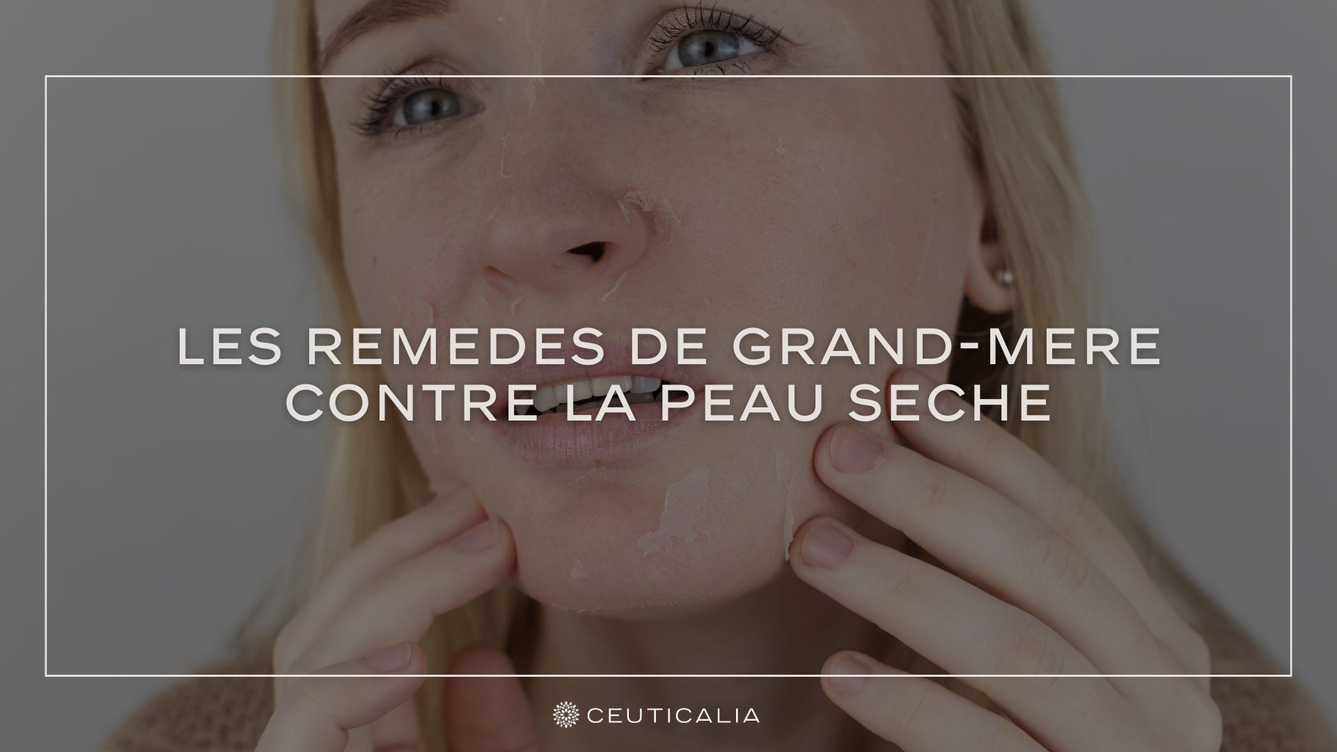 remède naturel pour mains très sèches