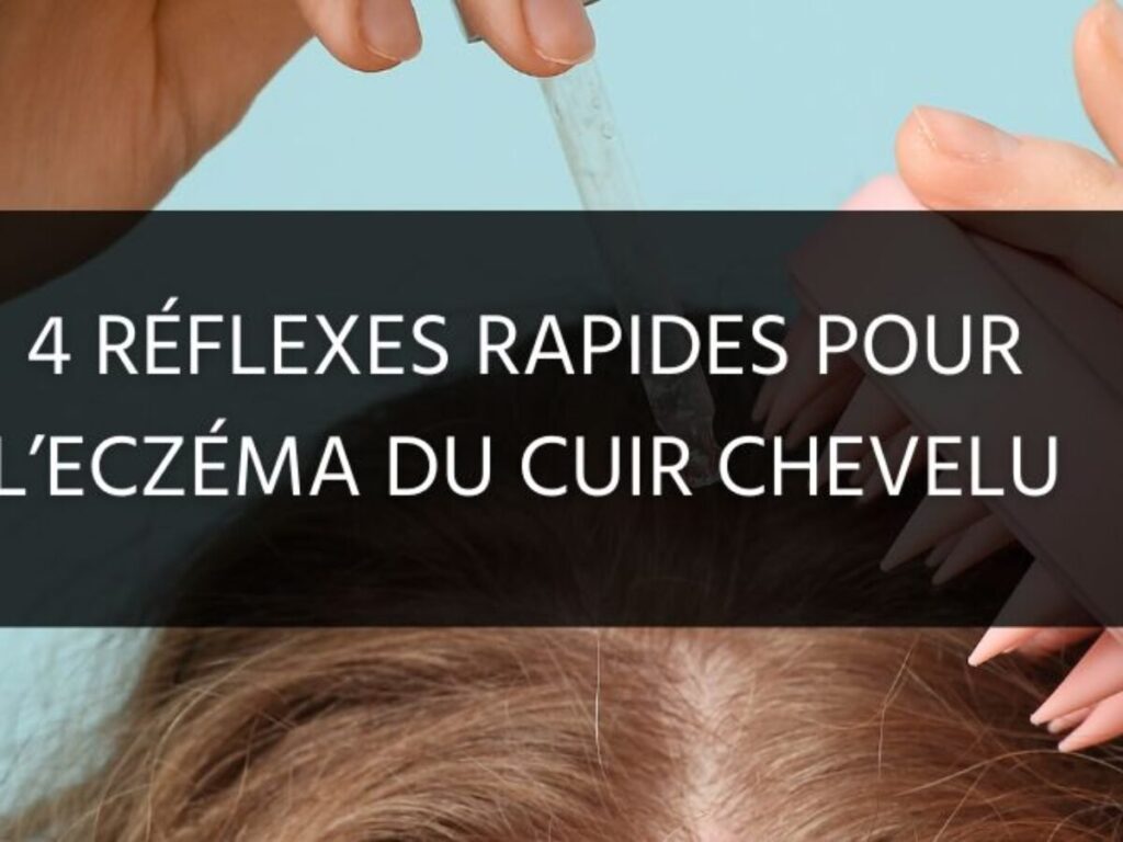 Femme apaisant son cuir chevelu irrité par l’eczéma avec un soin naturel