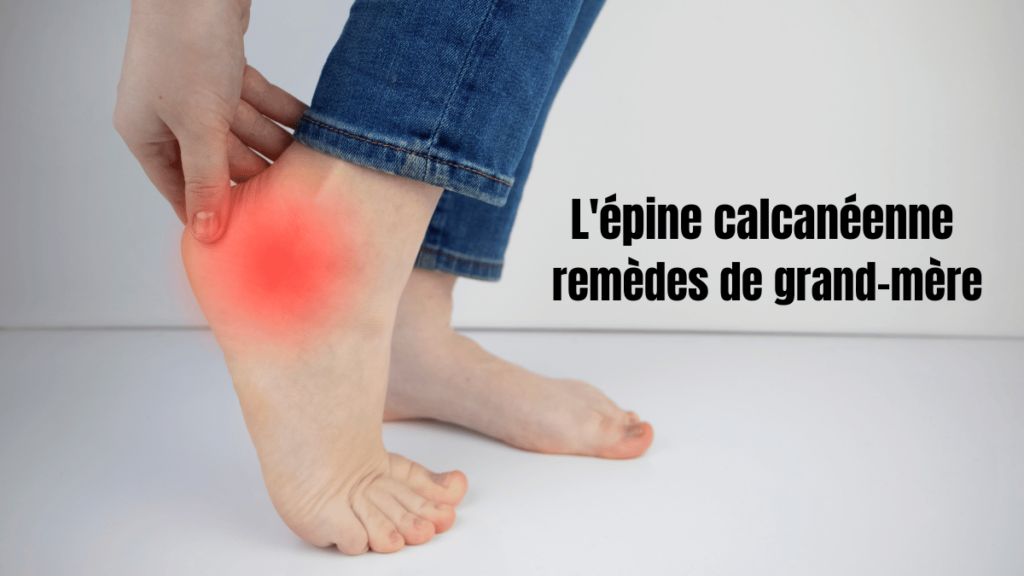 Illustration d'un talon avec épine calcanéenne et remèdes de grand-mère en arrière-plan