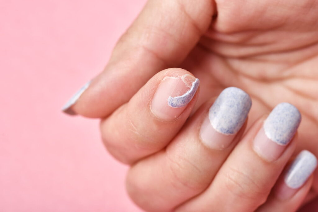 Ongles dédoublés sur une main avec aspect cassant, illustration des remèdes naturels