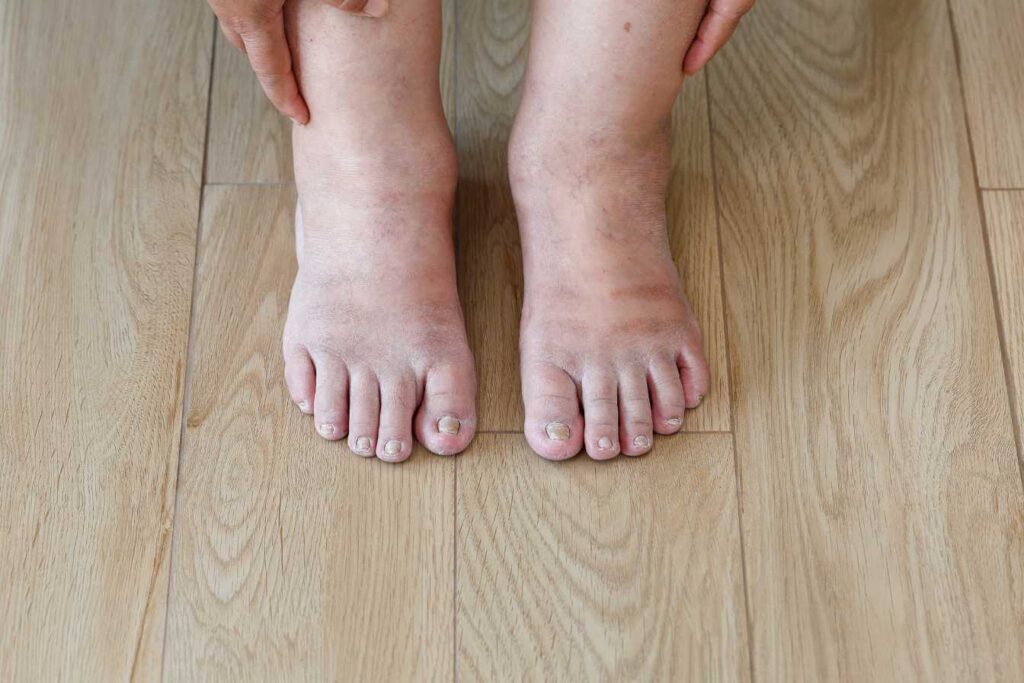 Femme appliquant un remède naturel sur ses jambes pour soulager la rétention d'eau