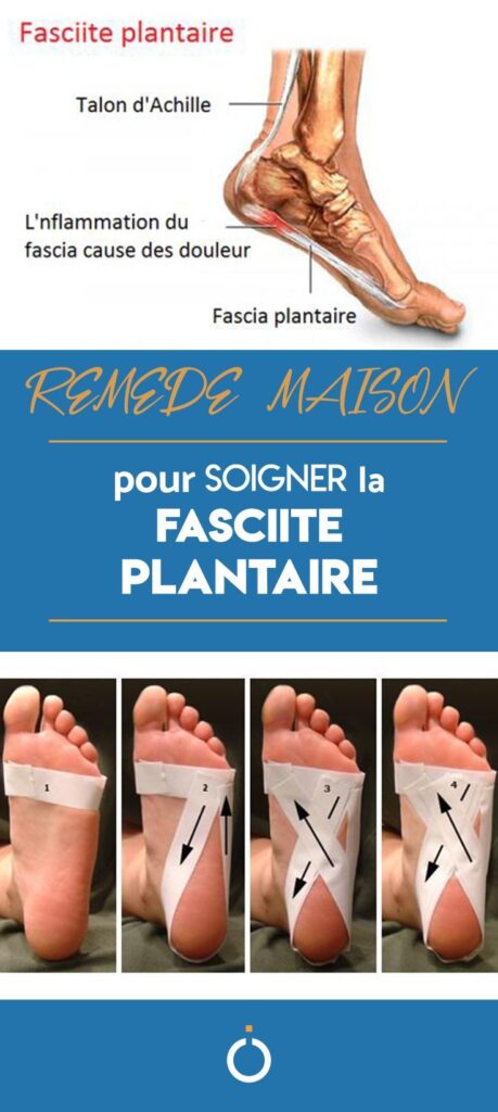 remède maison naturel pour soulager la fasciite plantaire au talon