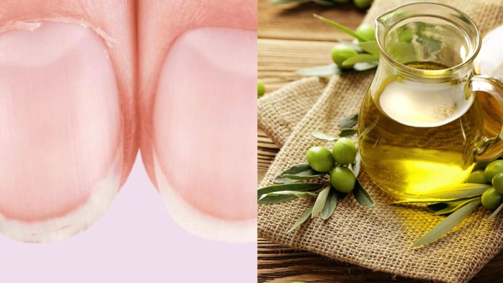 Remèdes de grand-mère naturels pour soigner les ongles abîmés