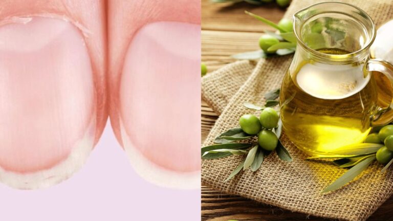 Remèdes de grand-mère naturels pour soigner les ongles abîmés