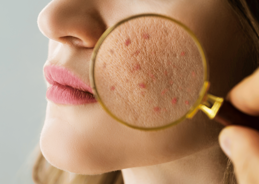 Comprendre et prendre en charge les problématiques dermatologiques